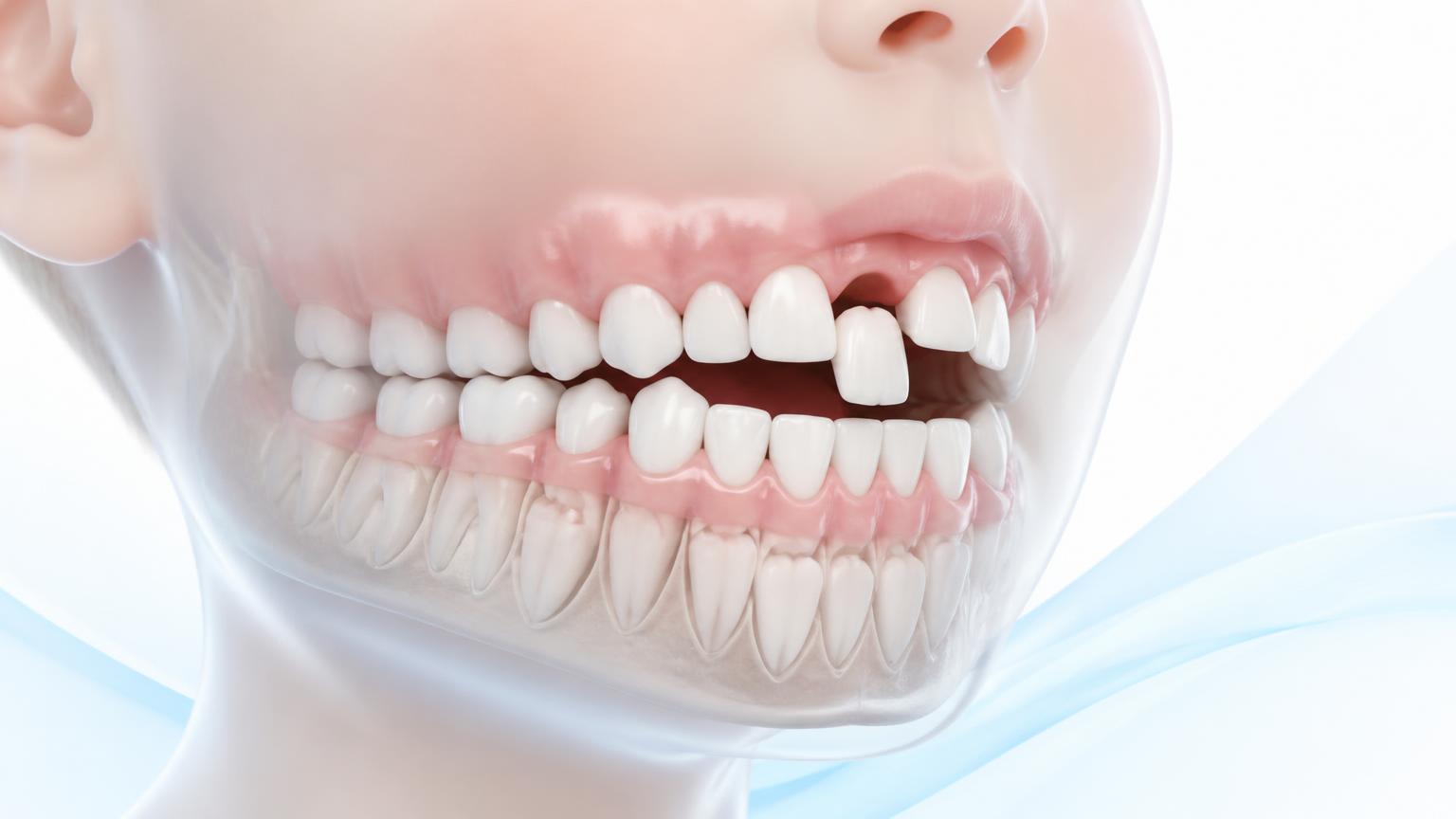 Dental illustration of baby teeth with permanent teeth developing underneath